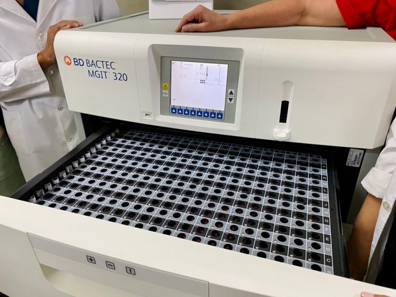 Salta cuenta con la mejor tecnología para diagnosticar tuberculosis